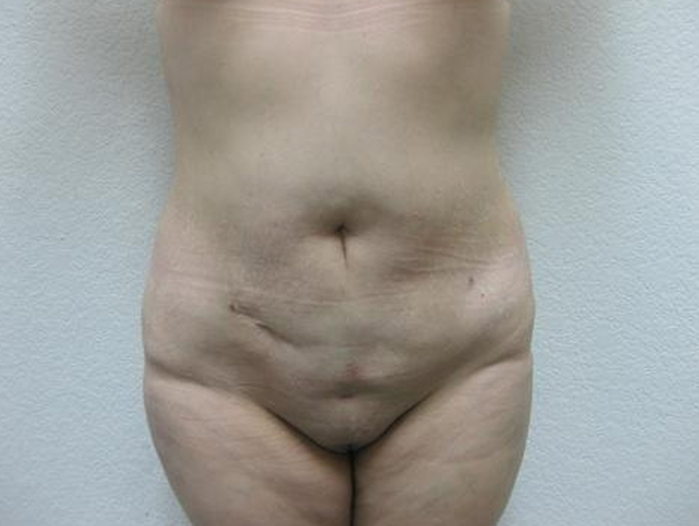 Case BD-2678 after photo