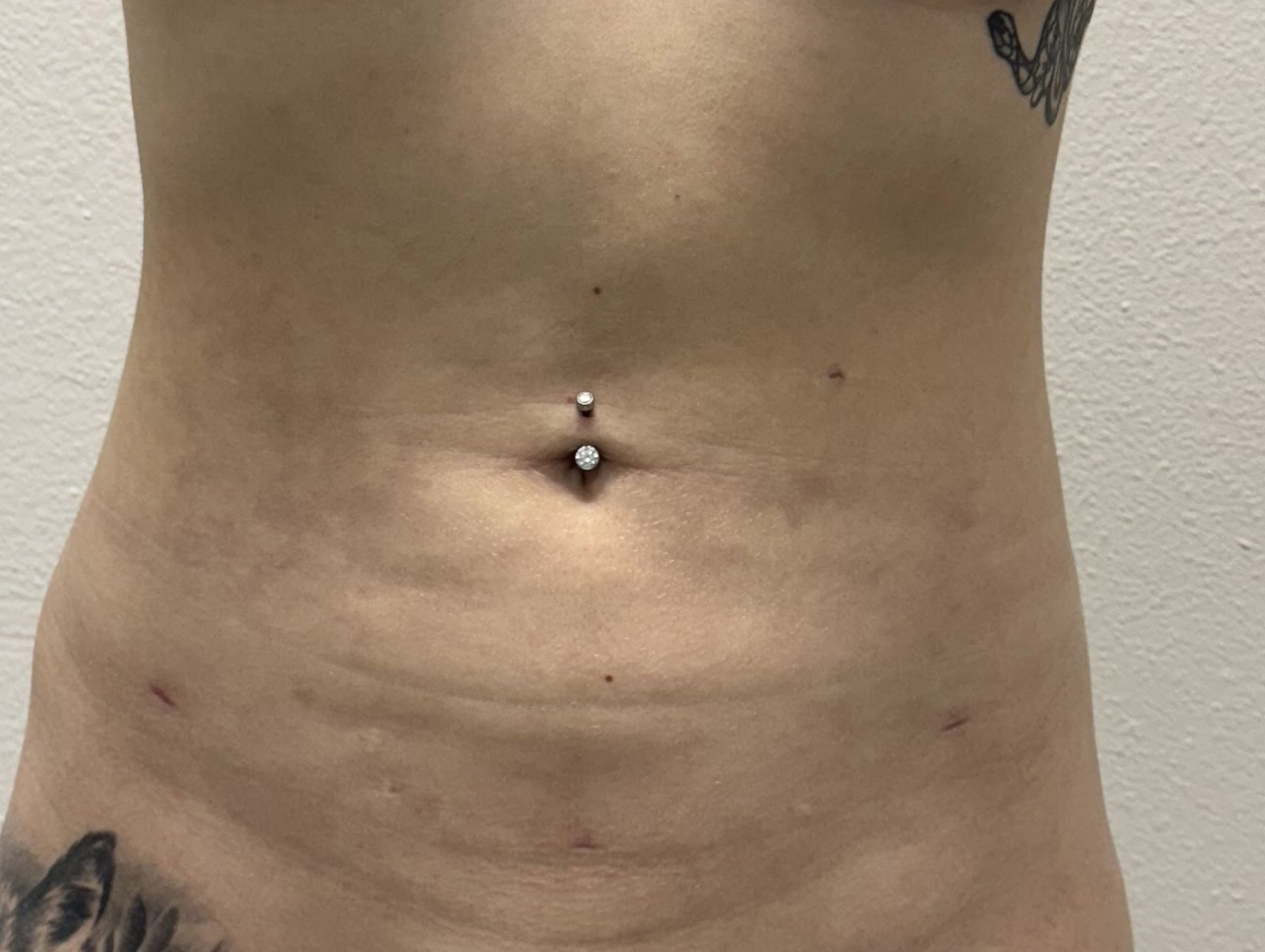 Case BD-2171 after photo