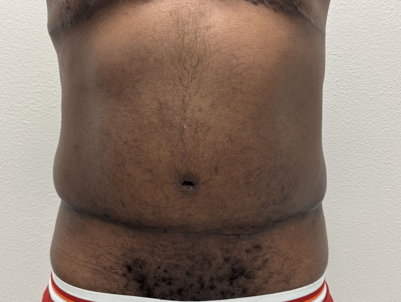 Case BD-1639 after photo