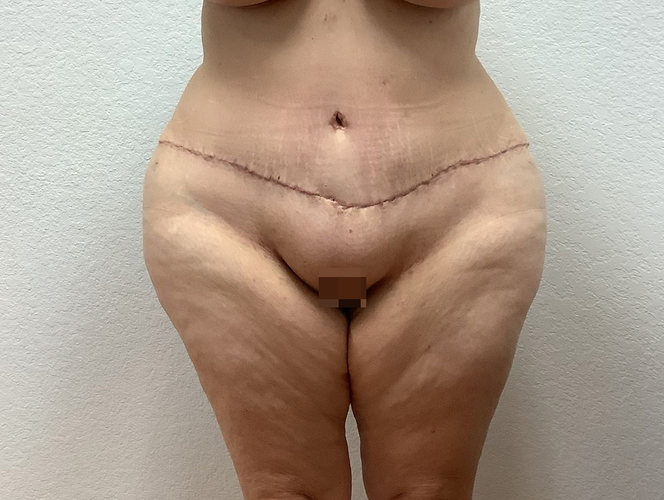 Case BD-7114 after photo