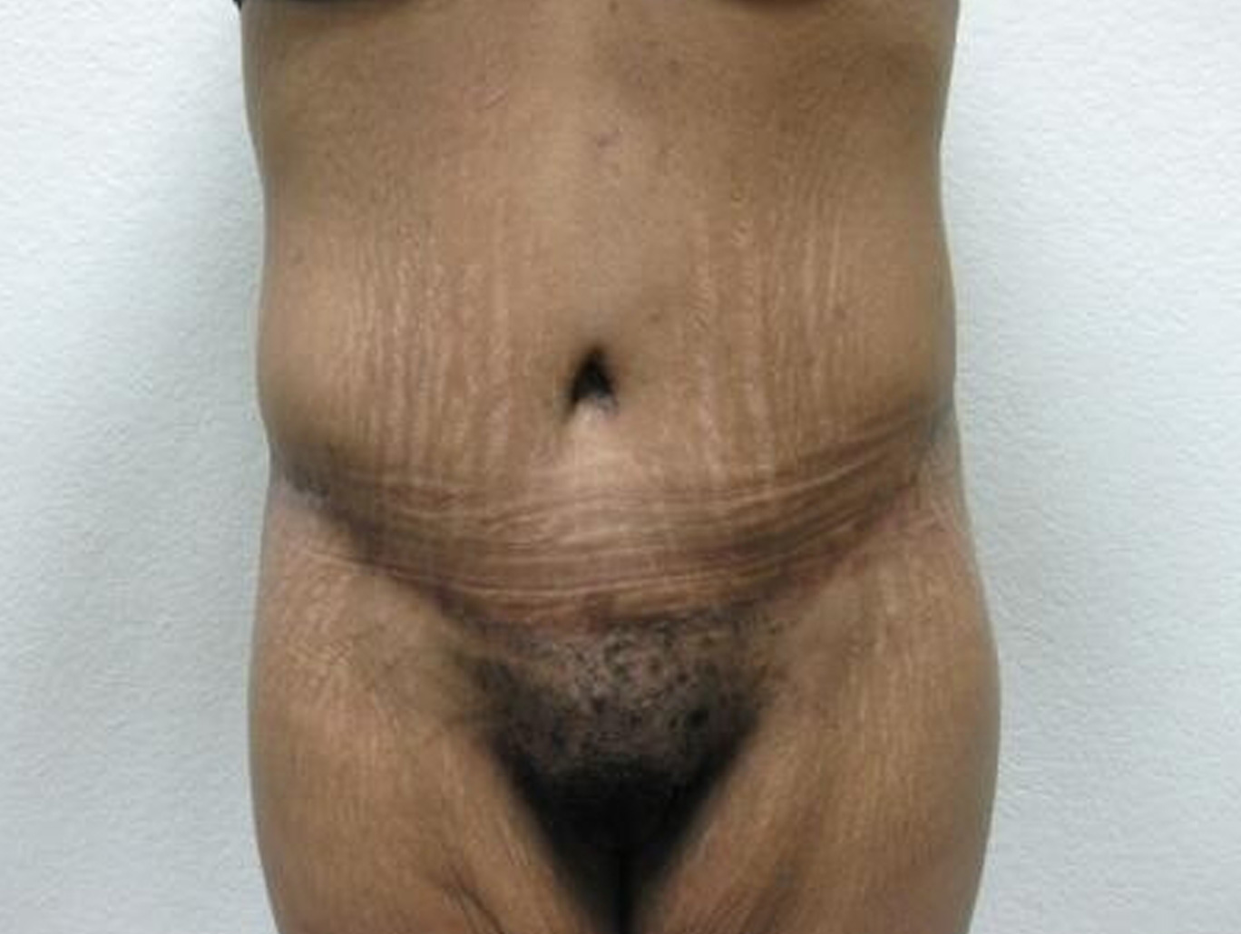 Case BD-7294 after photo